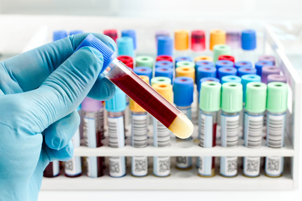 What are the types of Blood tests available at Hodgson Pharmacy