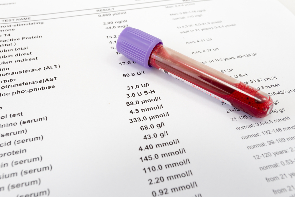 How to Improve Blood Test Results & Overall Health