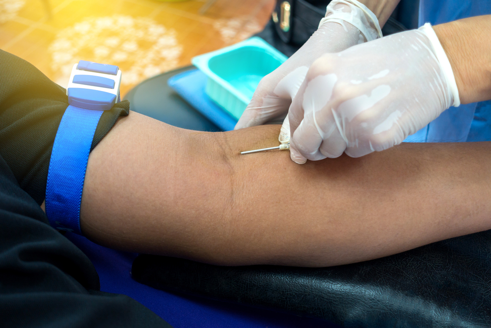Four Things You Need to Know Before Getting a Blood Test