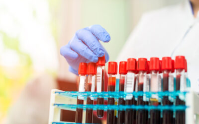 Common Blood Tests: What Do They Check For?