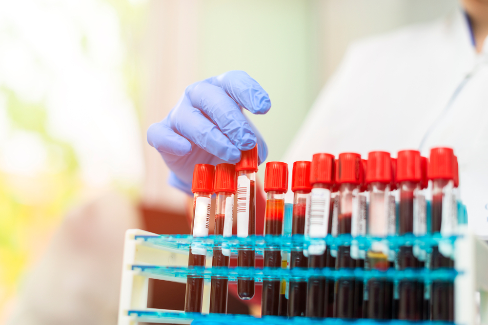 Preparing for a Blood Test: What You Need to Know