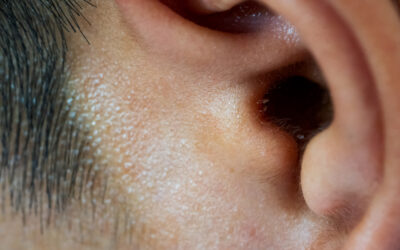 Ear Wax Removal: Why It’s Important and How to Do It Safely