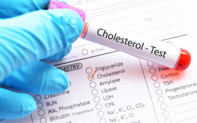 Where Can I Get a Cholesterol Test Near Me?