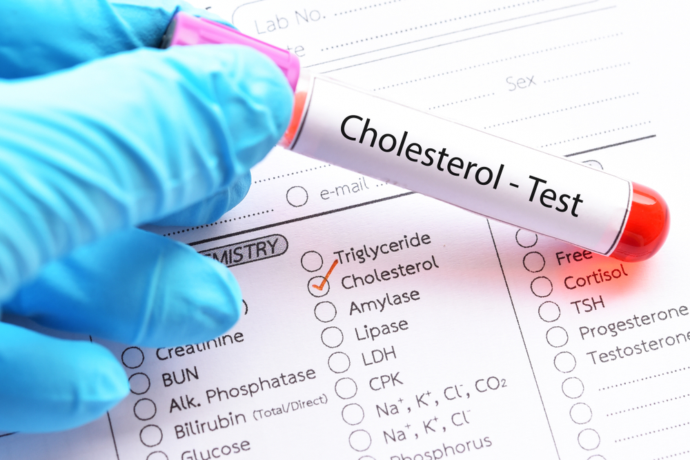 Cholesterol Test