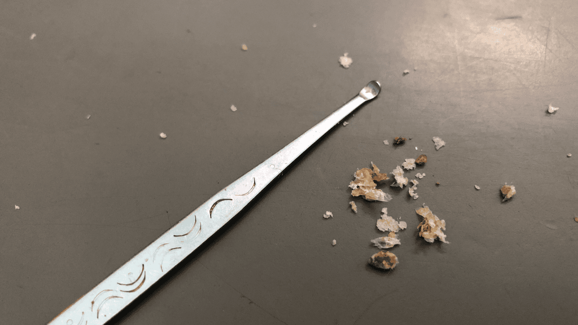 Dangers of DIY Earwax Removal